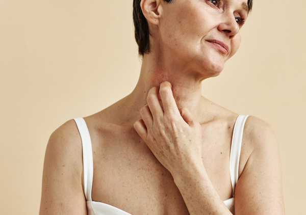 The Truth About Psoriasis: Symptoms, Triggers and Support That Actually Helps