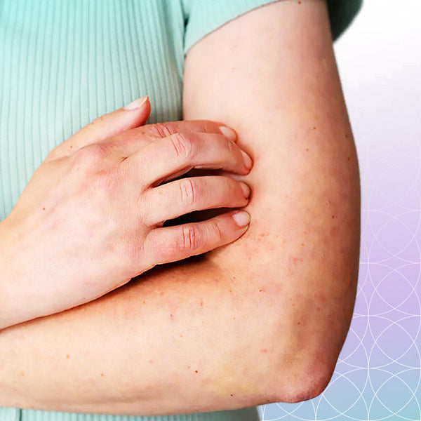 Products for Psoriasis