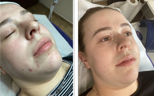 Our Client’s Skin Story: See The Transformation