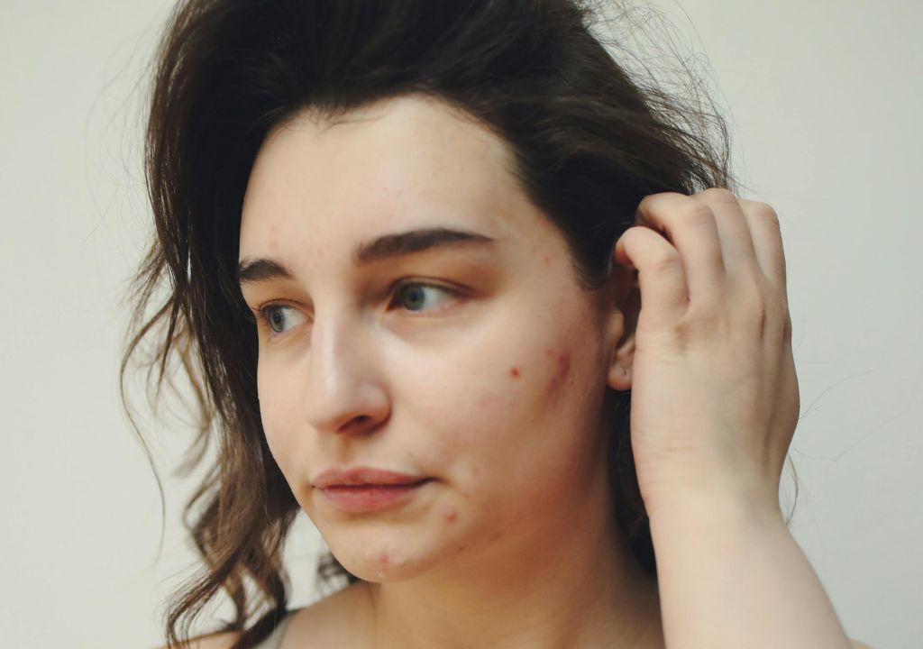 Stressed skin solutions to soothe and restore.