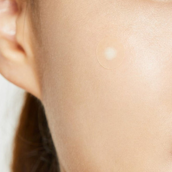 Pimple Patches