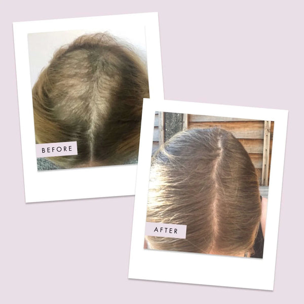 Hair Gain Capsules - 1 Month Supply