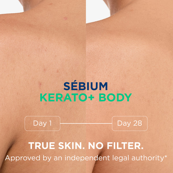 Bioderma Sebium Kerato+ Body Spray 150ml