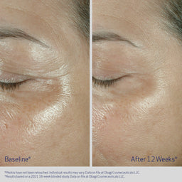 Obagi Elastiderm Eye Cream
