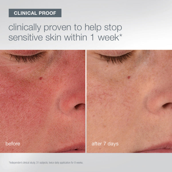 Before-and-after close-up of a person's nose and cheek showing skin improvement, with text reading 'CLINICAL PROOF' and 'clinically proven to help stop sensitive skin within 1 week*'.
