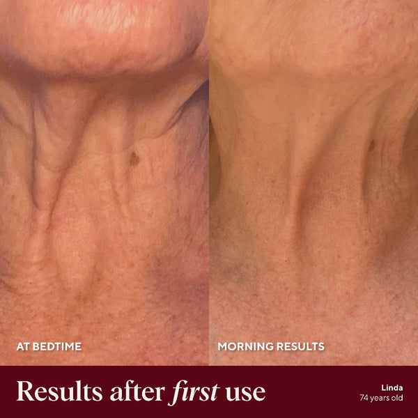 Before and after comparison of skin texture at bedtime and morning results, showing visible improvement.