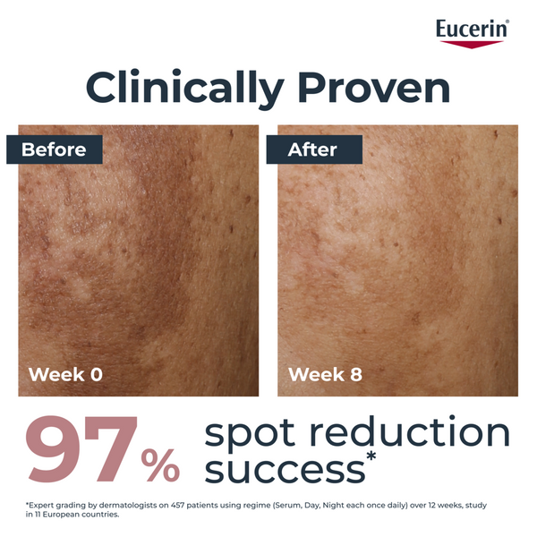 Eucerin Anti-Pigment Dual Serum 30ml