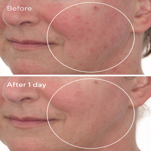 Murad Cellular Hydration Barrier Repair Mask