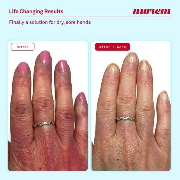 Nursem Caring Hand Cream Unfragranced 75ml