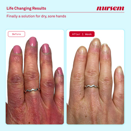 Nursem Hand Care Minis Set