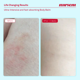 Nursem Skincare Discovery Set
