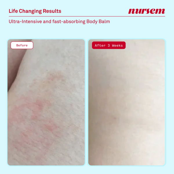Nursem Skincare Discovery Set