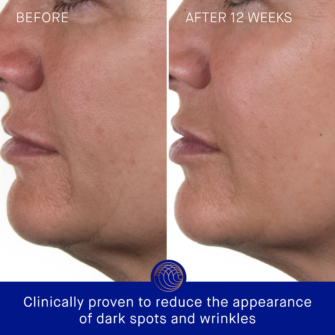 Before and after comparison of a person's face with text indicating clinical proven effects on dark spots and wrinkles.