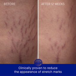 Augustinus Bader The Body Cream 100ml