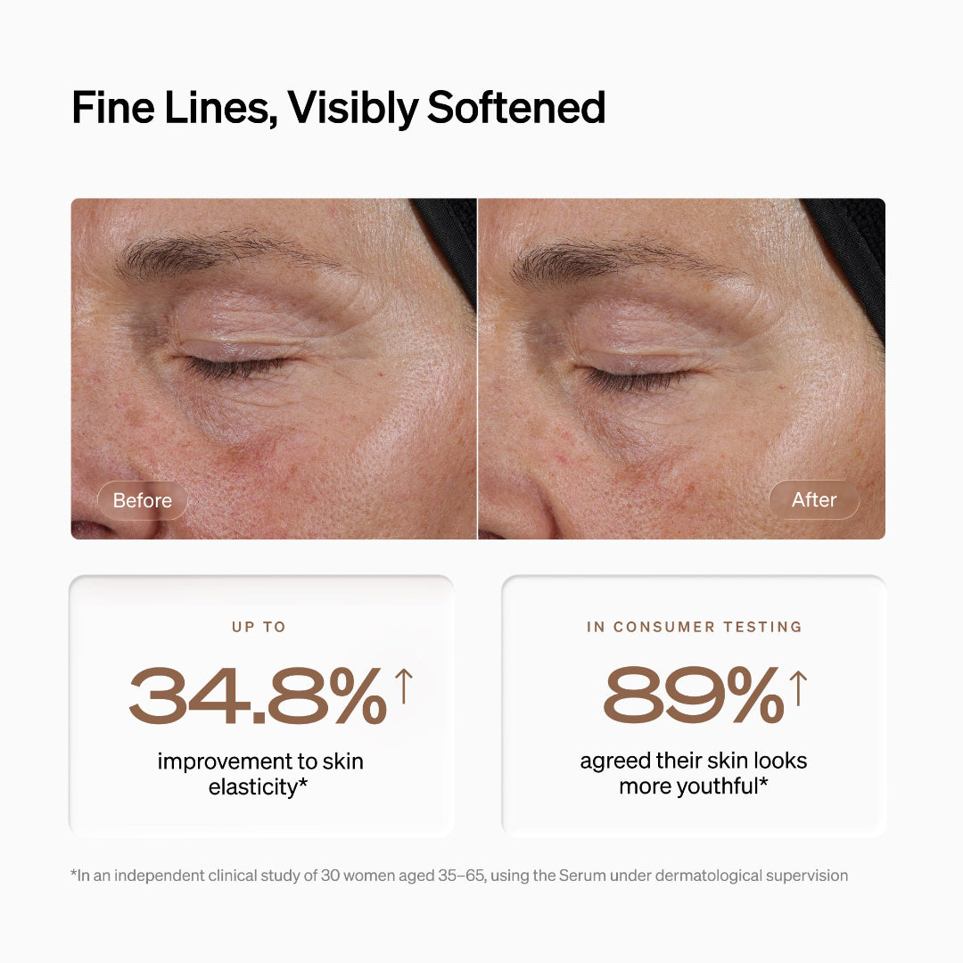 Before-and-after skincare comparison showing a woman's eye area with fine lines and wrinkles, with text stating 'Fine Lines, Visibly Softened' and results of up to 34.8% improvement in skin elasticity and 89% agreement that skin looks more youthful.