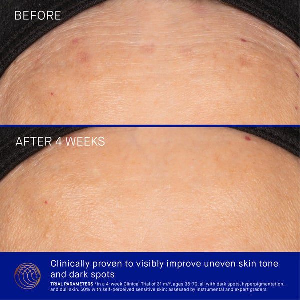 Before and after comparison of skin texture improvement with text indicating results after 4 weeks.