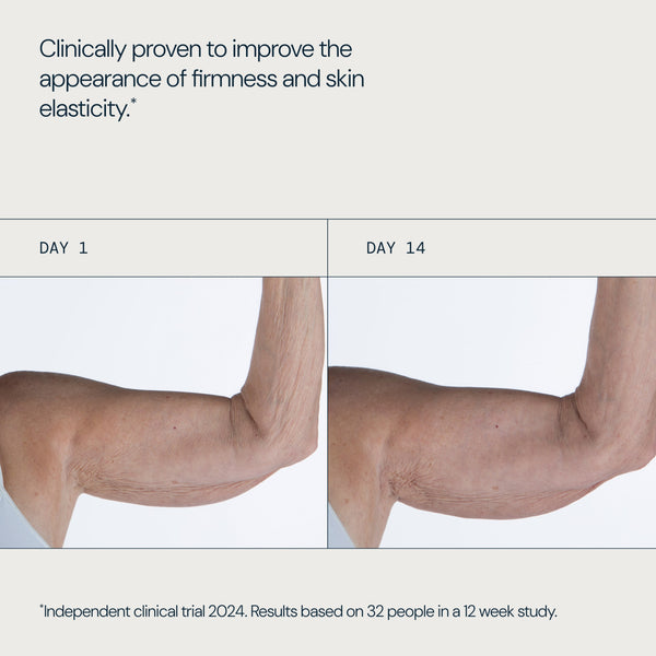 Before-and-after comparison of a human arm showing skin elasticity improvement, with text stating 'Clinically proven to improve the appearance of firmness and skin elasticity' and 'DAY 1' and 'DAY 14' labels.