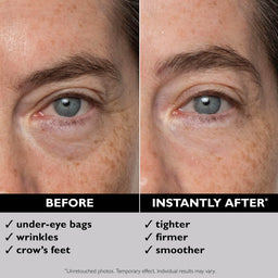 Peter Thomas Roth FIRMx Eye Duo Set