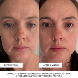 BEAUTYPRO PHOTON LED Light Therapy Mask