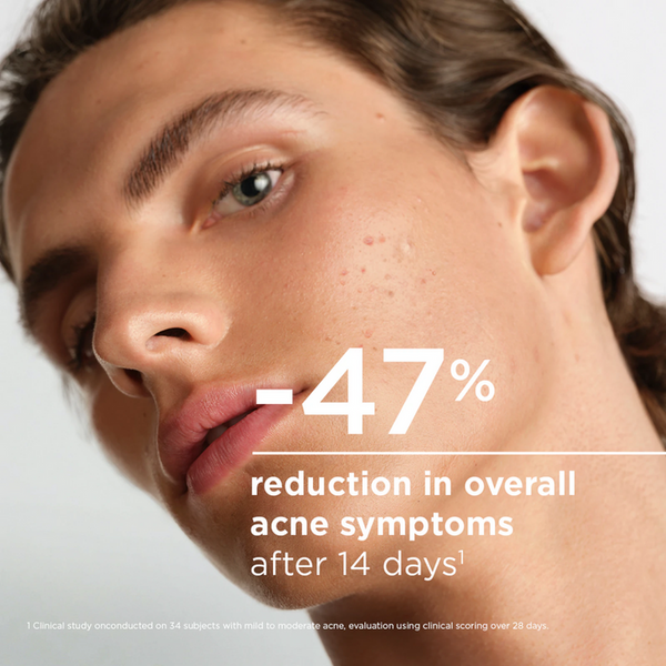 Bioderma Sebium Kerato+ Body Spray 150ml