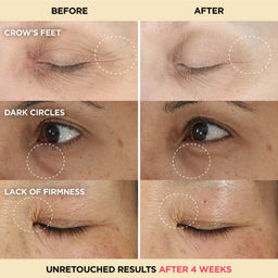 iT Cosmetics Confidence in an Eye Cream Anti-Aging Peptide Eye Cream 15ml