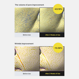 Before and after comparison of pore and wrinkle improvement with numerical percentages shown.