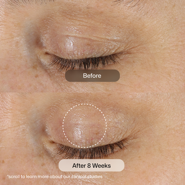 Close-up of a closed eye showing skin before and after 8 weeks of treatment, with a 'Before' label over the upper eye and an 'After 8 Weeks' label over the lower eye with a dotted outline highlighting smoother, less textured skin.