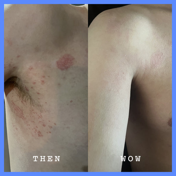 Frank Body Hyaluronic Acid Body Serum 50ml