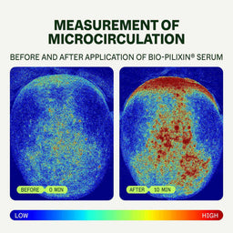 Before and after measurement of microcirculation using Bio-Pilixin Serum on a circular surface.