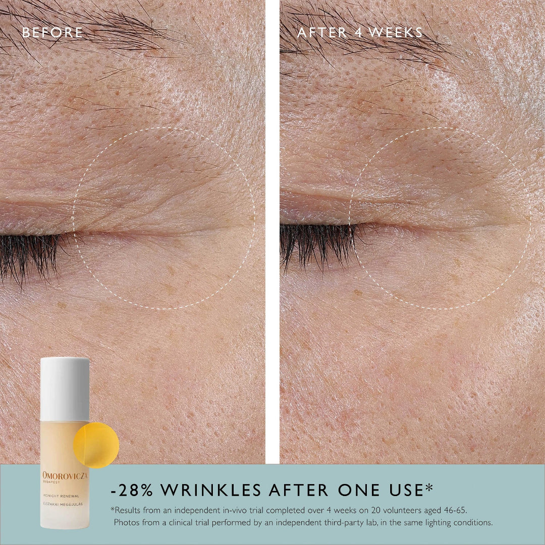 Before and after comparison of wrinkles on skin with a skincare product bottle shown.