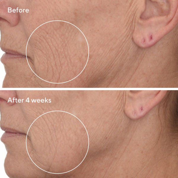 Murad Retinal ReSculpt Overnight Treatment