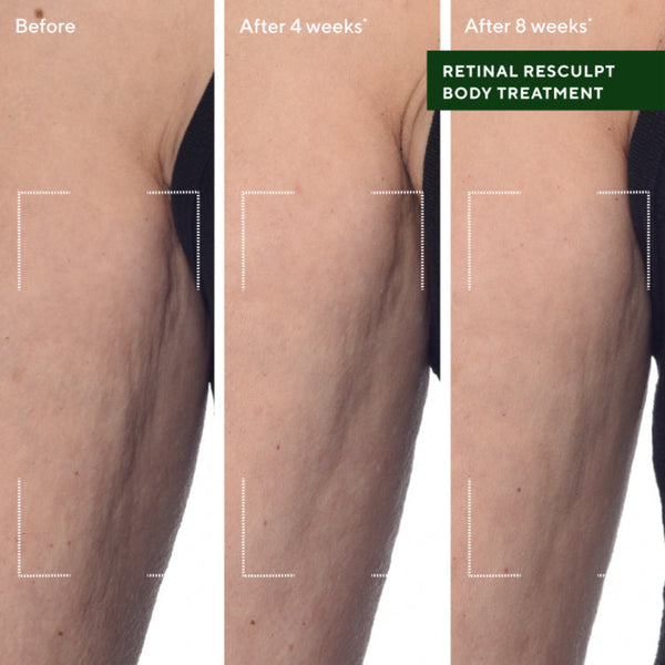 Murad Retinal ReSculpt Body Treatment
