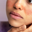 Products by Skin Problem