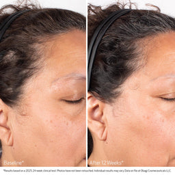 Obagi Nu-Cil Biostim Scalp Serum