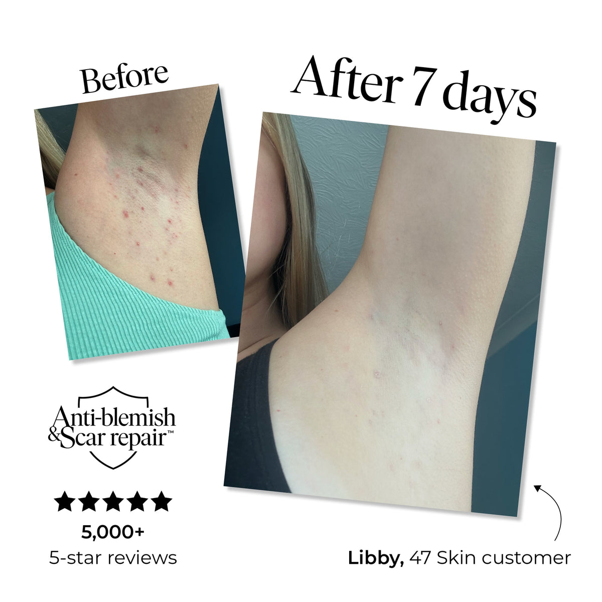 47 Skin Treatment Wash (Body) 150ml