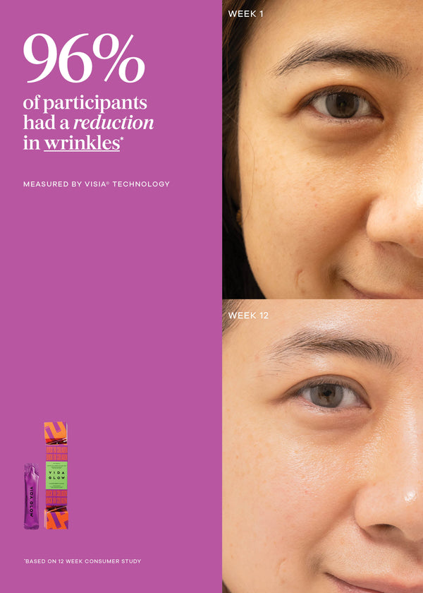 Advertisement showing a before-and-after comparison of wrinkles with a purple background and text about Wrizia technology.