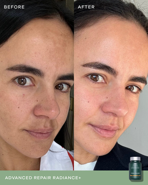 l carnitina bajar de peso La L-Carnitina te ayuda a convertir la grasa en energía La L-Carnitina es un nutriente esencial que se encarga de convertir la grasa en energía. #GNC #lcarnitina l carnitina bajar de peso La L-Carnitina te ayuda a convertir la grasa en energía La L-Carnitina es un nutriente esencial que se encarga de convertir la grasa en energía. #GNC #lcarnitina