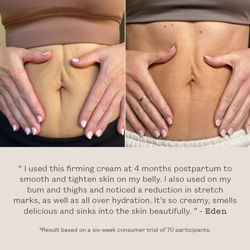 Before and after comparison of a person's belly with hands touching, showing the effect of a firming cream.