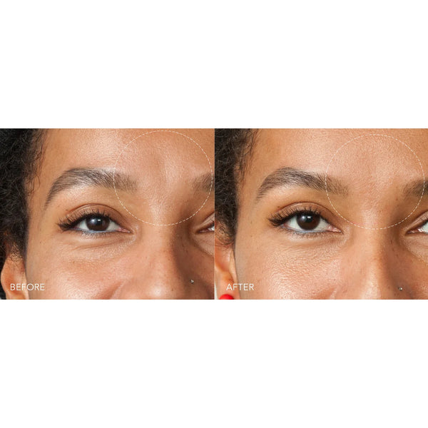 Before and after comparison of a woman's eye area on a white background